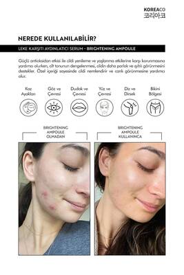 Koreaco Brightening Ampoule 50 ML