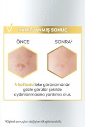 Nivea Leke Karşıtı Cilt Bakım Serumu 30ml-1adet - Thumbnail