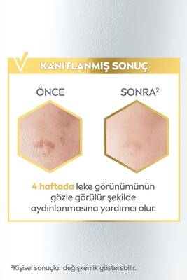 Nivea Leke Karşıtı Cilt Bakım Serumu 30ml-1adet